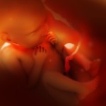 rebenok-v-utrobe-materi